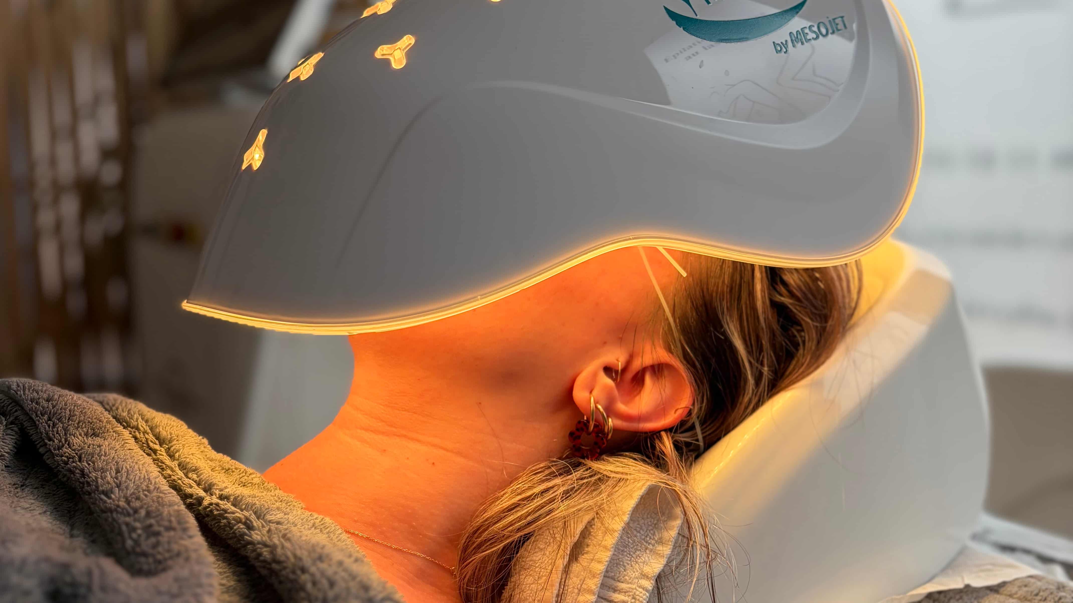 Photobiomodulation Mirradia